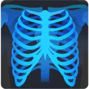 MicroDicom DICOM Viewer